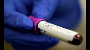 Ohio Department of Health to contact 1,200 households for COVID-19 antibody testing