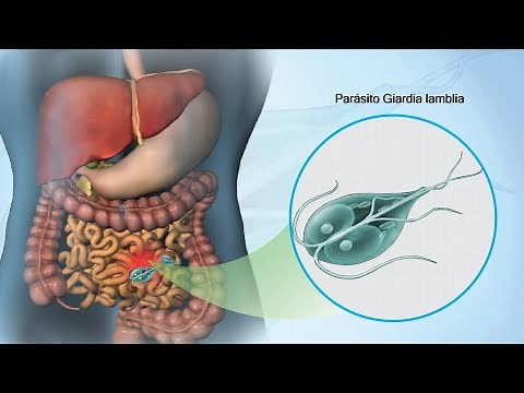 Giardia lamblia | Etiology, Clinical Features, Diagnosis, and Treatment of Giardiasis | Parasitol...