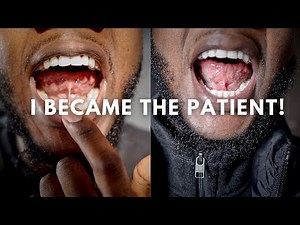 Getting a Lingual Frenectomy (Tongue Tie Release)!