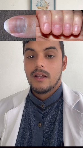 ¿ Qué son las líneas de Beau? #sigueme #doctorernestoguerra #medicina #consulta #datosinteresantes #obstetricia #medico #ginecologia #salud #datosmedicos | Dr.ernestoguerra.obs