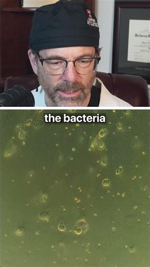 Prime Drink Vs Microorganisms Under the Microscope 🦠 Surgeon Reacts