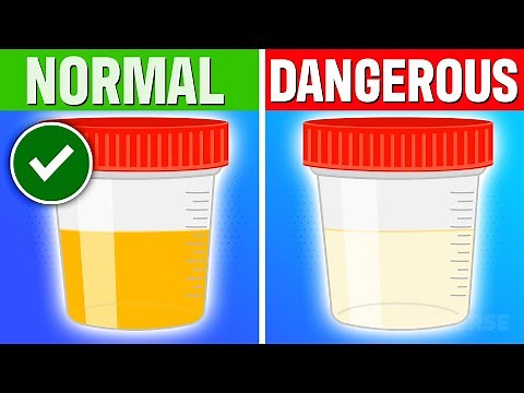 The Color Of Your URINE Is Saying THIS About Your Health! (Check Your Urine COLOR!)