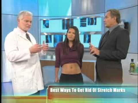 Dr. Harold Lancer - The Doctors - Stretch Mark Correction