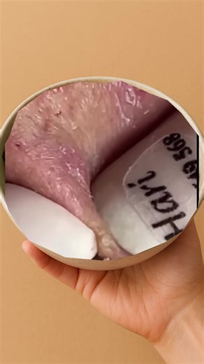 #squeeze #squeezeyuk