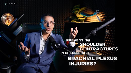 Preventing Shoulder Contractures in Children with Brachial Plexus Injuries | Educational Video by CEMA