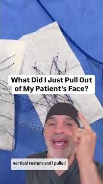(Warning) WHAT did I just pull out of my patient's face?! (THREADS!)