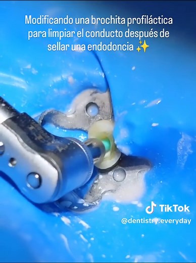 Modifying a Prophy Brush for Canal Cleaning | Dental DIY