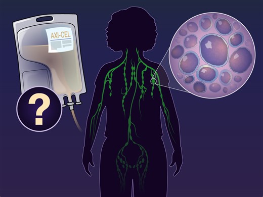 2.2K views · 63 reactions | Patients with relapsed or refractory large B-cell lymphoma after first-line chemoimmunotherapy have a poor prognosis. Second-line treatment with the CAR T-cell therapy axi-cel may improve outcomes. New research findings are summarized in a short video. https://nej.md/3sS5510 | The New England Journal of Medicine | Facebook