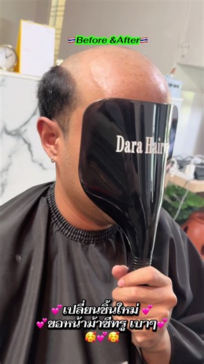 เคสนี้ก็น่ารักมากค่ะ💕🥰💕 #Darahairwig🇹🇭 #วิกผมผู้ชาย #วิกติดกาวช่างองุ่น 💚Contact 💚 Line Id: @dara_hairwig