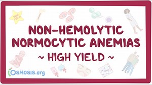 Non-hemolytic normocytic anemia: Pathology review: Video, Causes, & Meaning | Osmosis