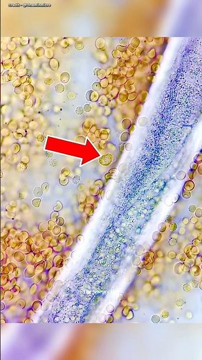 White Blood Cells ATTACK Giant Parasite Worm!