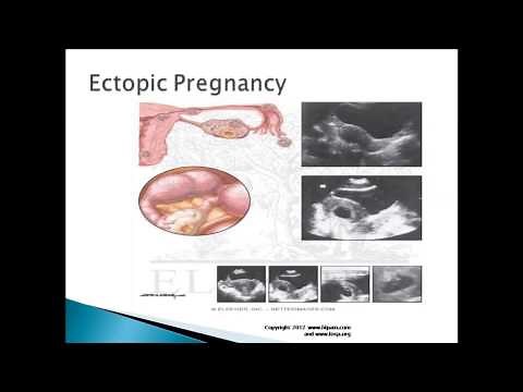 Pain in Lower Left Side of Stomach Symptoms, Causes and Treatment