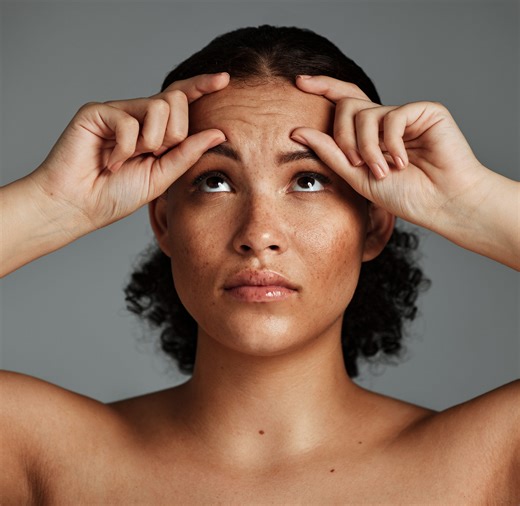 Dealing with Forehead Acne? Here's the Best Way to Treat It, According to Dermatologists