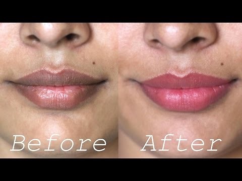 How to Lighten Dark Lips Naturally - Rapid Home Remedies