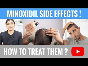 Side Effects of Minoxidil (Used in Hair Loss treatment for Men and Women!)