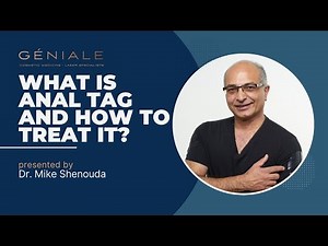 What is Anal Tag and How to Treat It? | Dr Mike Shenouda #nonsurgical #education