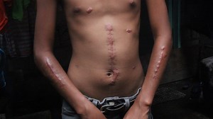 Children and Duterte’s drug war: Lessons from the past