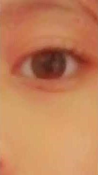 🎀🎀🎀❤️❤️💋🤔😘😘