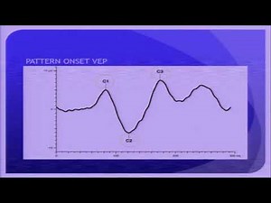 AIOC2018 - GP145 - Topic - Visually evoked potential : Clinical utility ( 5 min )