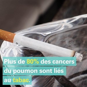 9.1K views · 87 reactions | Le cancer du poumon est la première cause de décès par cancer en Suisse. Plus de 80% des cancers du poumon dont liés au tabac. Des cancers détectés souvent trop tard. | Hôpitaux Universitaires de Genève | Facebook