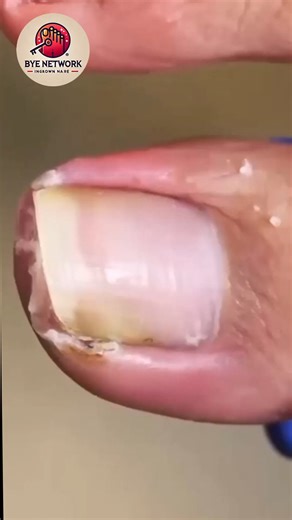 Nail Care Guide: Smart Advice for Long-Term Health Needs 😚️ #NailCareGuide #HealthEducation #EverydayWellness | Bye