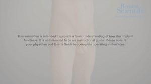 AMS 700 Penile Prosthesis Animation