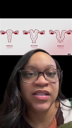 Explaining the process of uterus didelphys #doubleuterus