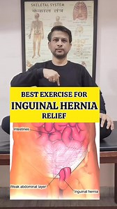 Best Exercise for Inguinal Hernia Relief #shorts #tranding #exercise | Dr.Nishant Gautam