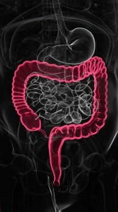 Ulcerative Colitis Indication X-ray in Vertical Video | Ulcerative Colitis X-ray in Vertical HQ Video