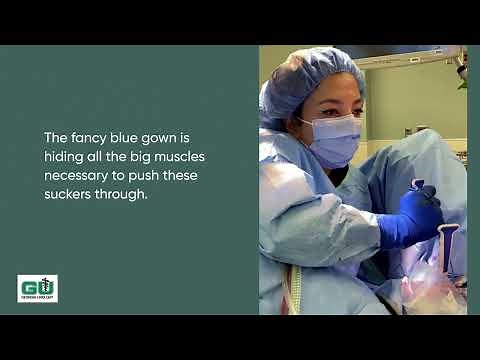 Mid Urethral Sling Surgery by Dr. Taghechian: A Solution for Urinary Incontinence