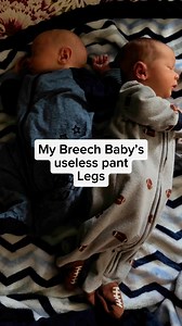 17M views · 120K reactions | My sweet baby A 凉 #twins #breech #breechbirth #momofmany | Amanda Lynn Sellers | Facebook