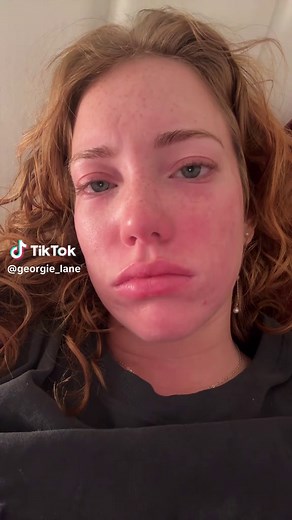Do Tears Make Eyelashes Grow? The Crying Myth Explained