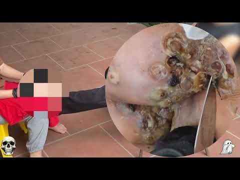 Extreme Jigger Infestation – Unexpected Deep Tissue Impact! #HN457