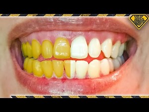 What Teeth Whitening Methods ACTUALLY Work?