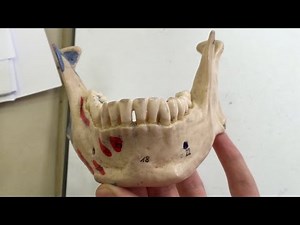 Anatomy of the Mandible & Hyoid