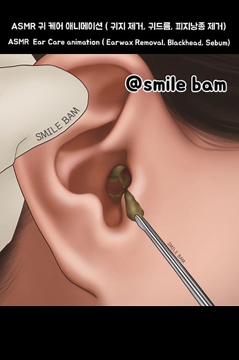 스마일밤 애니메이션 ASMR과 귀 청소 영상을 즐겨보세요