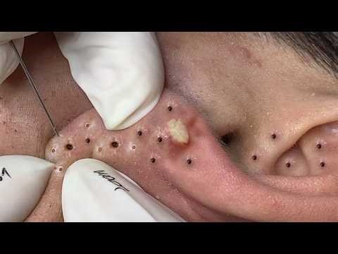 𝑅𝑒𝑐𝑙𝑎𝑖𝑚 𝑌𝑜𝑢𝑟 𝐺𝑙𝑜𝑤 𝐴𝑛𝑑 𝐶𝑎𝑙𝑚 𝑇ℎ𝑟𝑜𝑢𝑔ℎ 𝑀𝑖𝑛𝑑𝑓𝑢𝑙 𝑆𝑘𝑖𝑛𝑐𝑎𝑟𝑒 𝑀𝑜𝑚𝑒𝑛𝑡𝑠| 𝐷𝑒𝑒𝑝 𝐶𝑙𝑒𝑎𝑛𝑠𝑖𝑛𝑔 & 𝑆𝑜𝑜𝑡ℎ𝑖𝑛𝑔 𝑀𝑎𝑠𝑠𝑎𝑔𝑒 #9084