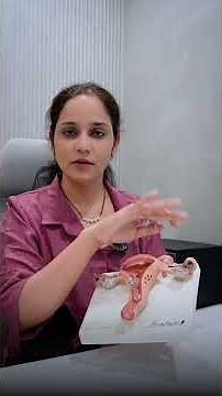 Risk Factors, Symptoms of Ovarian Torsion | Ovarian Torsion | Dr. Kavita Darade