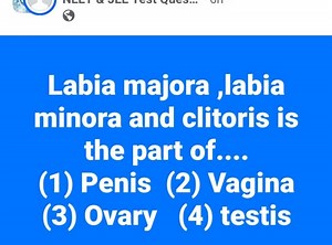 Labi majora, labia minora and clitoris is the part of.... (1) ... | Filo