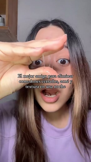 Nataly Cordova Palomino on Instagram: "Snail Mucin 95 es el mejor amigo para eliminar comedones cerrados, acné y textura 🤝🏻 @jumiso_latam #comedones #acneskincare #pimple #pimples #pimplesolution #comedones #comedonescerrsdos #acne #acné #acnetreatment #acnetips #skincarejunkie #acneproneskin #acneskin #snailmucin #snailmucinessence #kbeauty #beauty #itgirl #fypシ❤️💞❤️ #fypシ #girls #reels #acne"