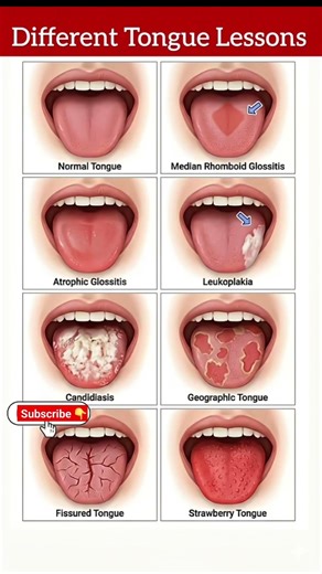 Your Tongue Reveals Your Health! 5 Warning Signs You Must Know #healthylifestyle #healthyeating