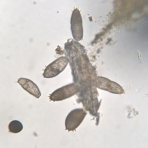 Dr. Hunter | These are ciliates called Coleps. They can hunt and scavenge for food, despite being only a single cell. These barrel shaped ciliates are... | Instagram