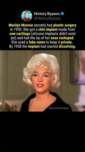 Did Marilyn Monroe Have Plastic Surgery? #shorts