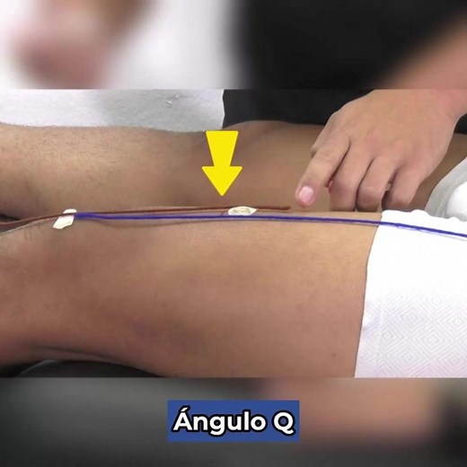 Ángulo Q es el que se forma cuando trazamos una línea que va desde la Espina Iliaca Antero Superior, al centro de la patela, y otra línea que va desde el centro de la rótula hasta la tuberosidad anterior de la tibia, quédate en este clip y aprende con nosotros.🤓 #anguloq #fisio #fisioterapia #fisioterapeuta #fisioterapialapasionquenosune #fisioterapiaenmovimiento #fisioterapialapasionquenosune #fisioterapiaenmovimiento #ortopedia | Fisioterapia en Movimiento