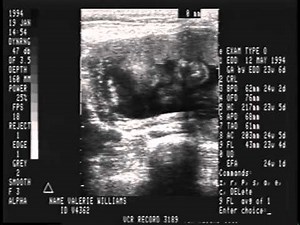 Williams Family Home Videos 1994 -1