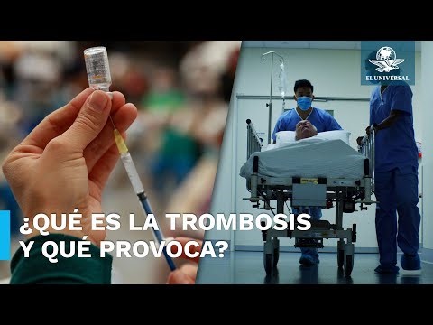 Esto debes saber sobre la Trombosis, enfermedad con la que ligan la vacuna antiCovid de AstraZeneca