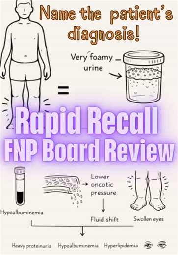 Nephrotic syndrome is a classic high-yield topic for the FNP boards, 3P exam, and primary care certification exams. The key is recognizing the pattern of findings rather than memorizing isolated facts. Nephrotic syndrome occurs when the glomerular filtration barrier becomes damaged, allowing large amounts of protein to leak from the blood into the urine. On the boards, this damage typically occurs at the level of the podocytes, which normally act as part of the filtration barrier that prevents p