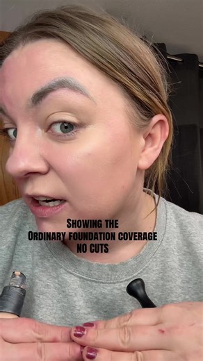 The Ordinary Foundation Review: Exceptional Coverage for Rosacea