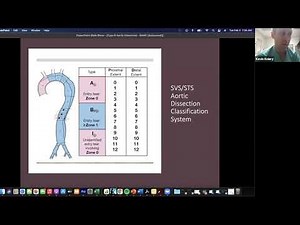 Acute Type B Aortic Dissection