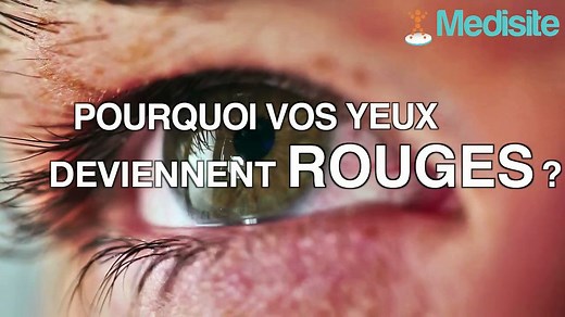 Pourquoi vos yeux deviennent rouges